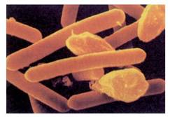 1. Irudia: Clostridium botulinum; toxina arriskutsuenetako bat sortzen du.<br>